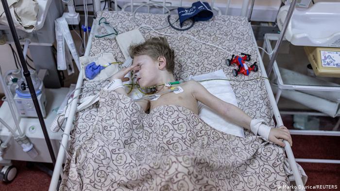 Раненный трехлетний ребенок по имени Дима из Мариуполя в больнице Запорожья, фото 29 марта 2022 года